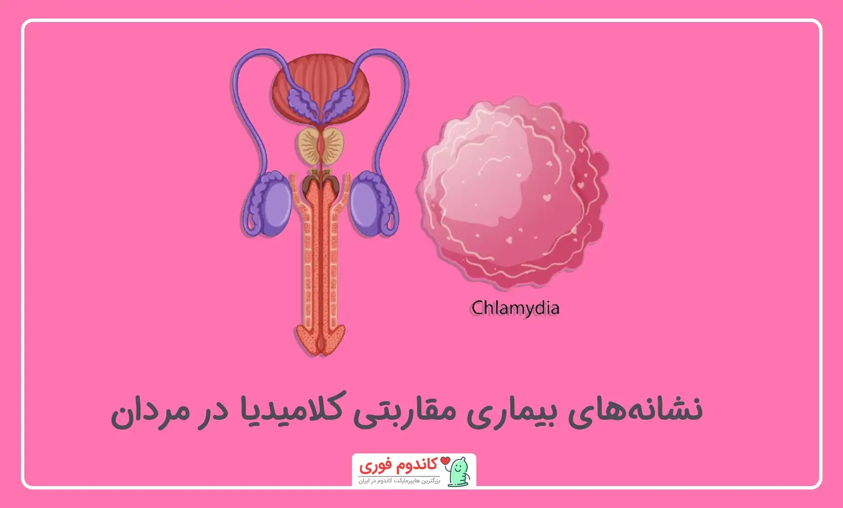 نشانه کلامیدیا در مردان
