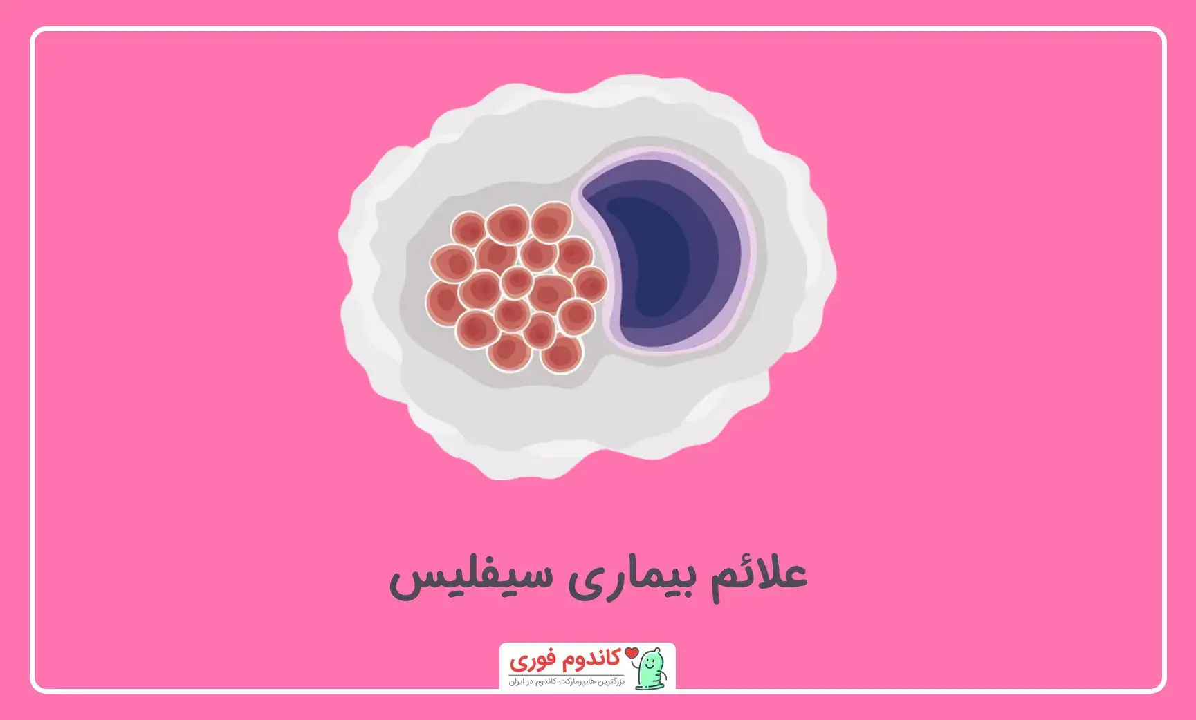 نشانه های بیماری مقاربتی سیفلیس