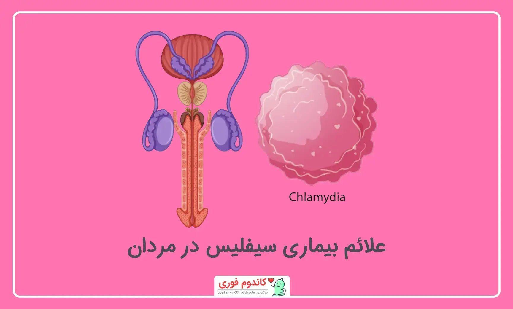 نشانه‌های سیفلیس در مردان